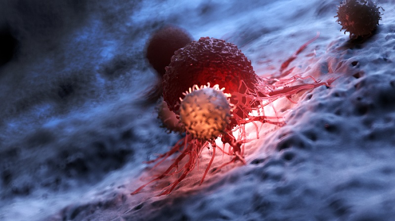 Imagen: El modelo predictivo de IA identifica las células inmunes que matan cáncer más potentes para su uso en inmunoterapias (foto cortesía de Shutterstock)